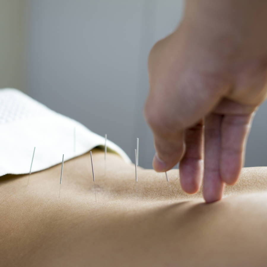 acupuntura tradicional