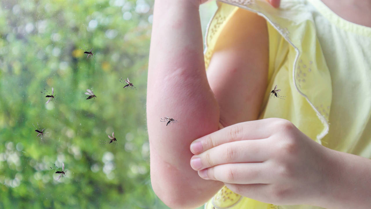 Niña con picaduras de mosquito