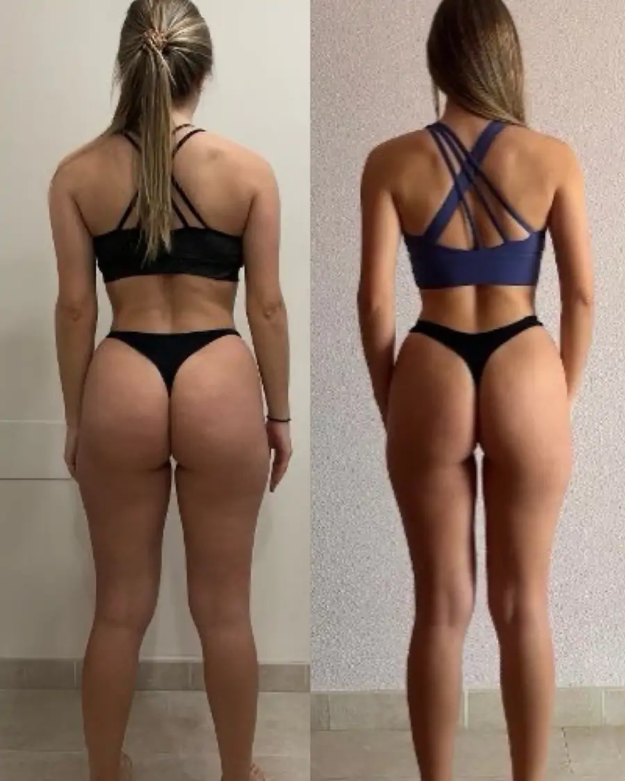antes y despues perdida de peso